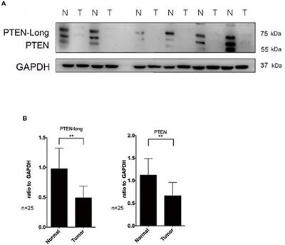 Purified PTEN-Long Induces Liver Cancer Cells to Undergo Autophagy and Apoptosis